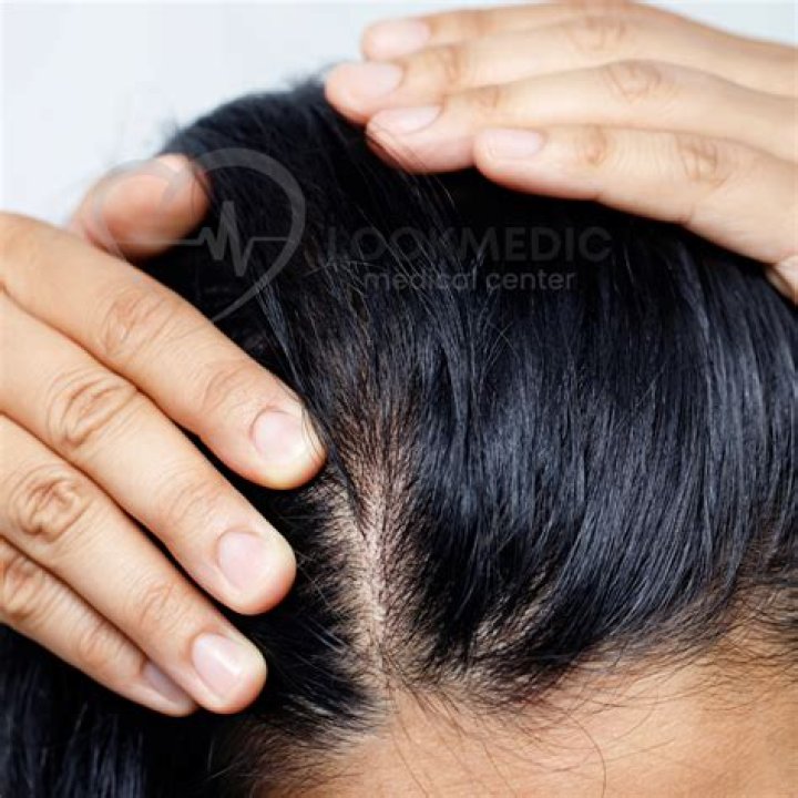 Can dead hair follicles grow back?