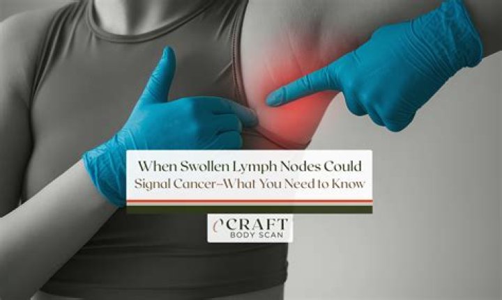 Do cancerous lymph nodes move?